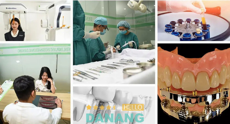 Nha Khoa Đà Nẵng Implant