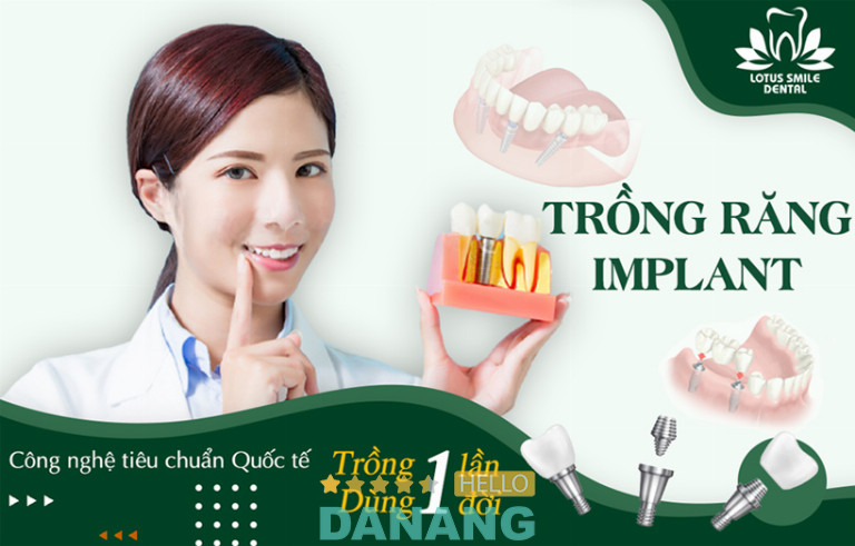 Nha Khoa Quốc tế Lotus Smile Dental Đà Nẵng