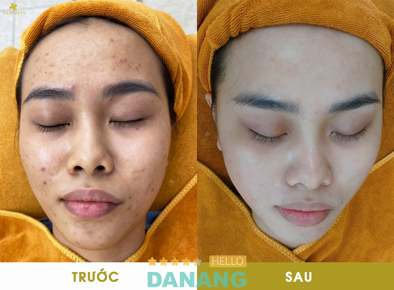 La Beauty Đà Nẵng