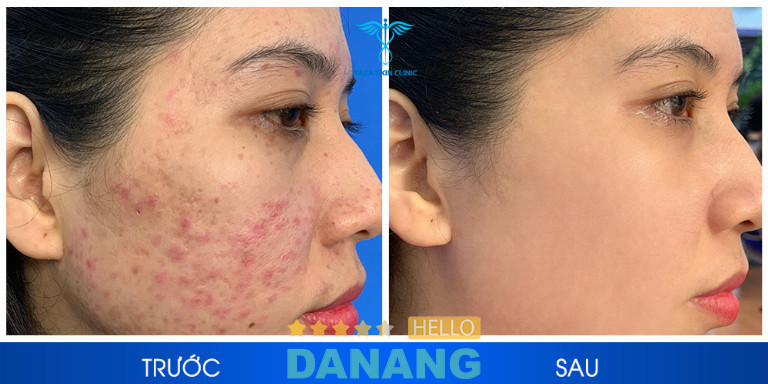 Taza Skin Clinic Đà Nẵng