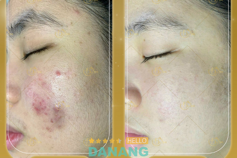 B Spa tại Q. Hải Châu, Đà Nẵng