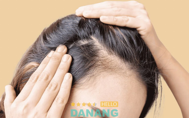 Viện Cấy Tóc Cella, Đà Nẵng