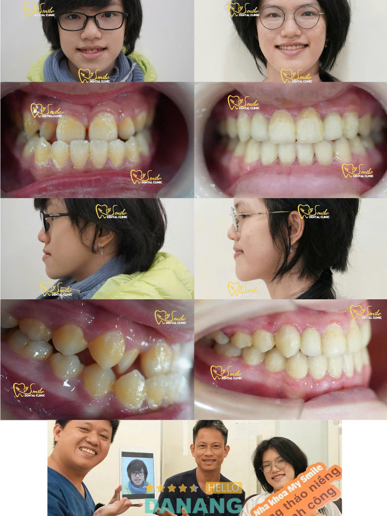 Nha Khoa My Smile Đà Nẵng