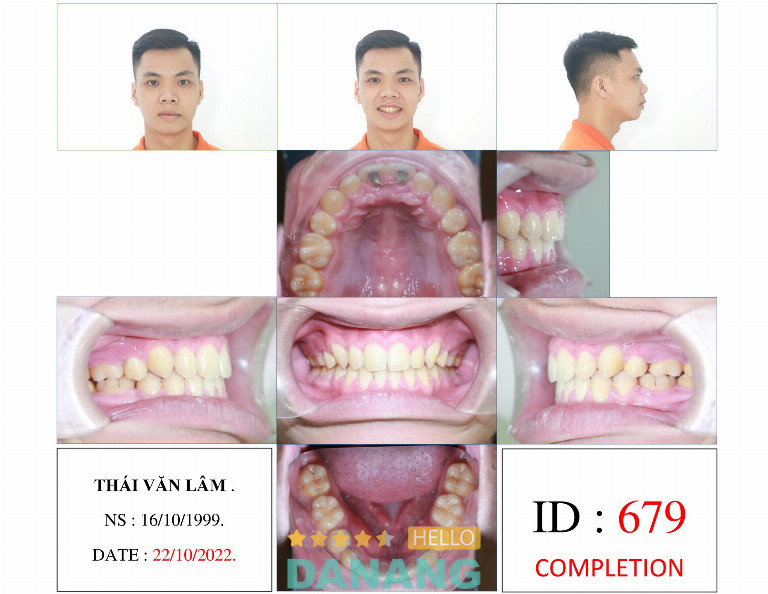 Nha Khoa A & T
