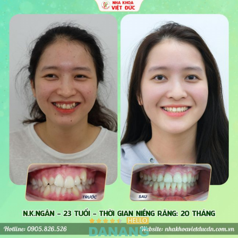 Nha Khoa Quốc Tế Việt Đức