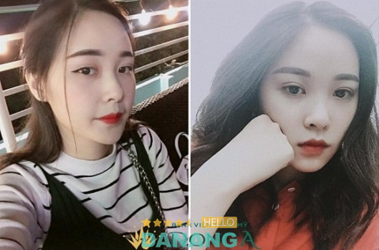 Thẩm Mỹ Viện Đông Á, Đà Nẵng