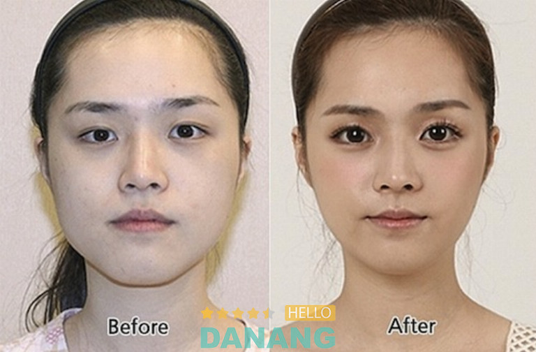 Thẩm Mỹ Beauty Center By Tấm, Đà Nẵng