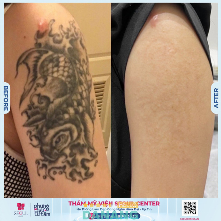 Thẩm mỹ viện Seoul Center