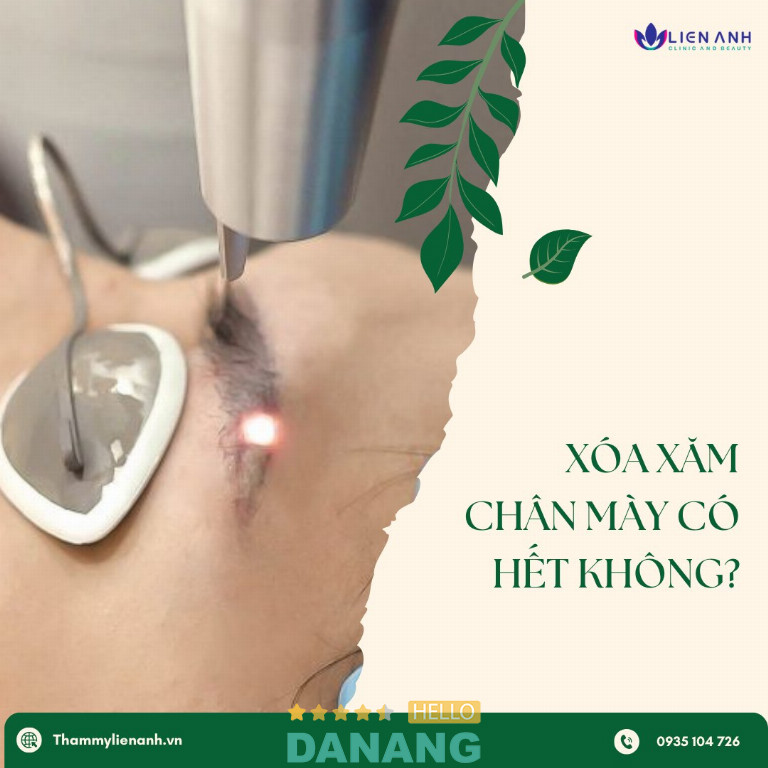 Thẩm mỹ Liên Anh (Liên Anh Clinic)