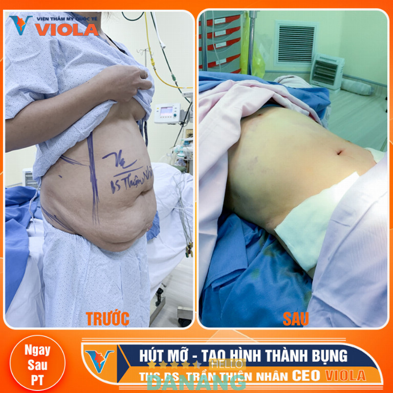 Viện thẩm mỹ Quốc tế VIOLA - P. Hòa Cường