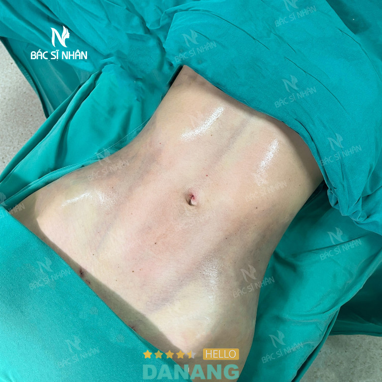 Thẩm mỹ viện BS Nhân - P. Hải Châu