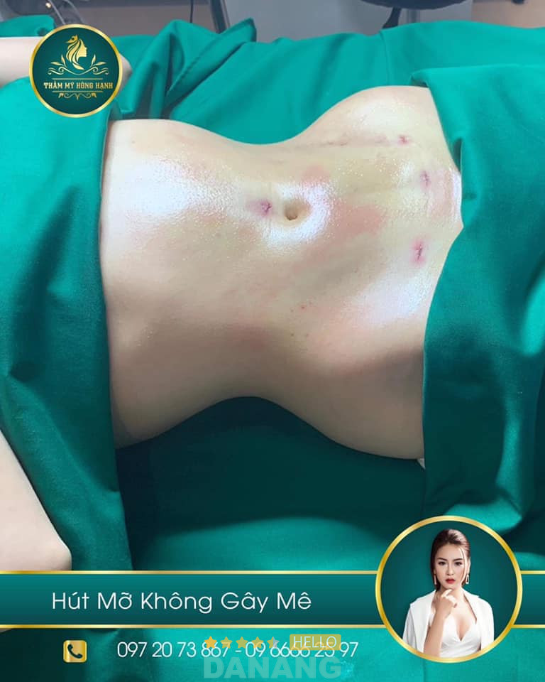 Thẩm Mỹ Hồng Hạnh - P. Thanh Khê