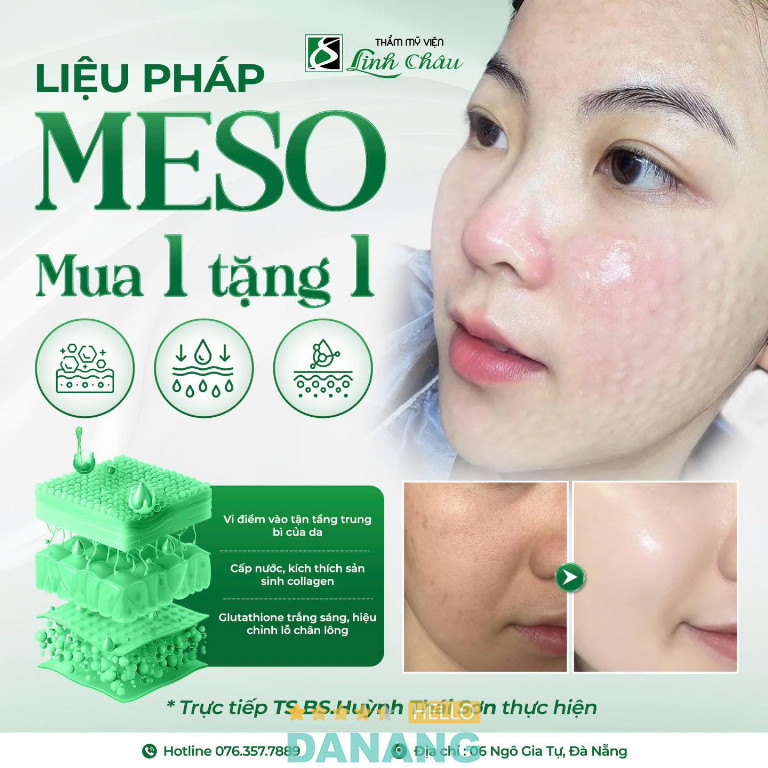 Thẩm mỹ viện Linh Châu – Hải Châu