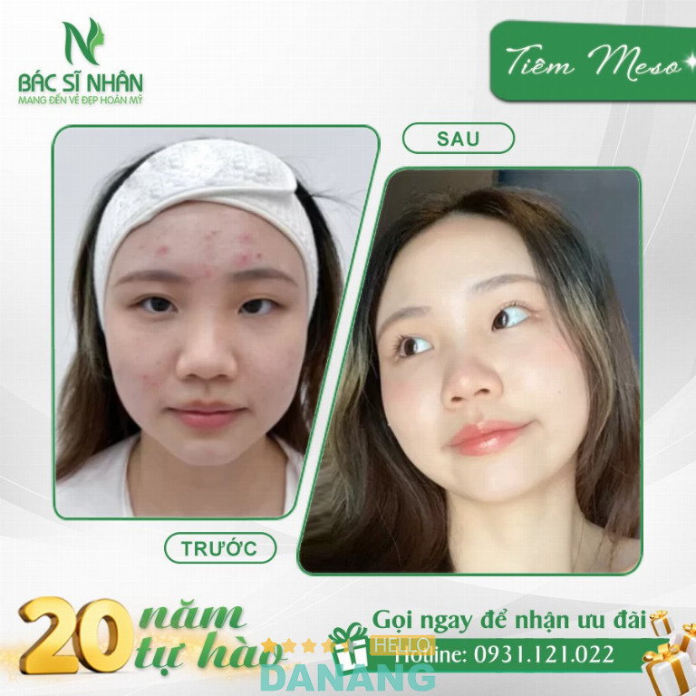 Thẩm mỹ viện BS Nhân – Hải Châu