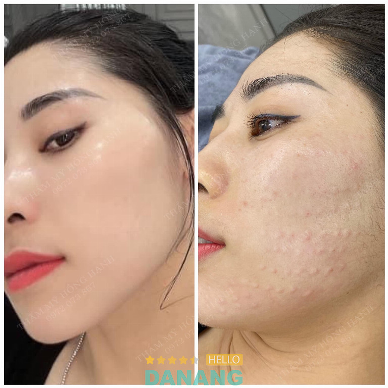 Thẩm mỹ Hồng Hạnh - Thanh Khê