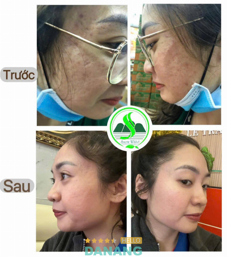 Spa Snow White Đà Nẵng - P. Hòa Khánh