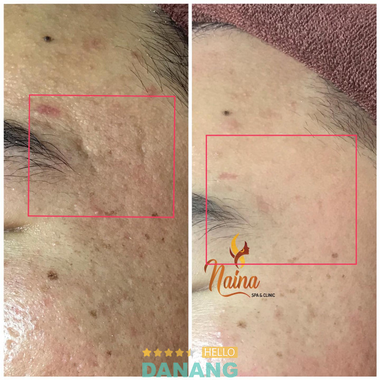 Naina Spa - P. Hải Châu