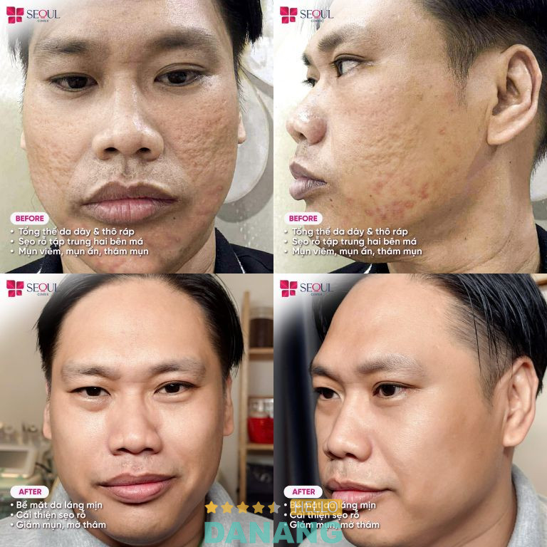 Thẩm Mỹ Seoul Center - P. Thanh Khê