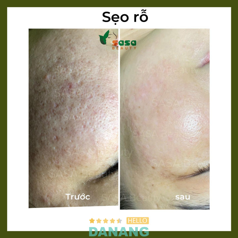 SASA Beauty - P. Hải Châu