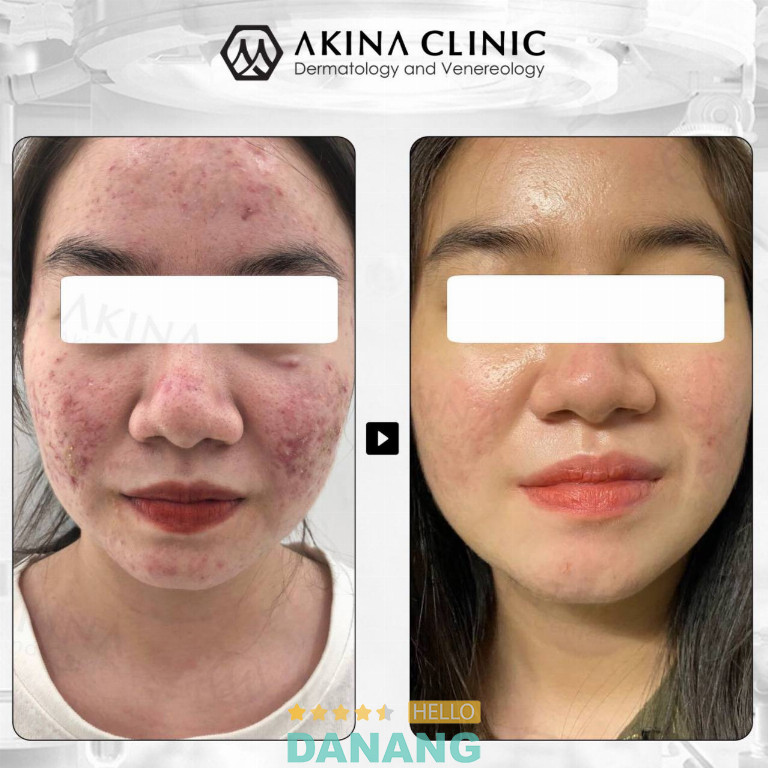 Phòng khám AKINA Clinic - P. Hải Châu