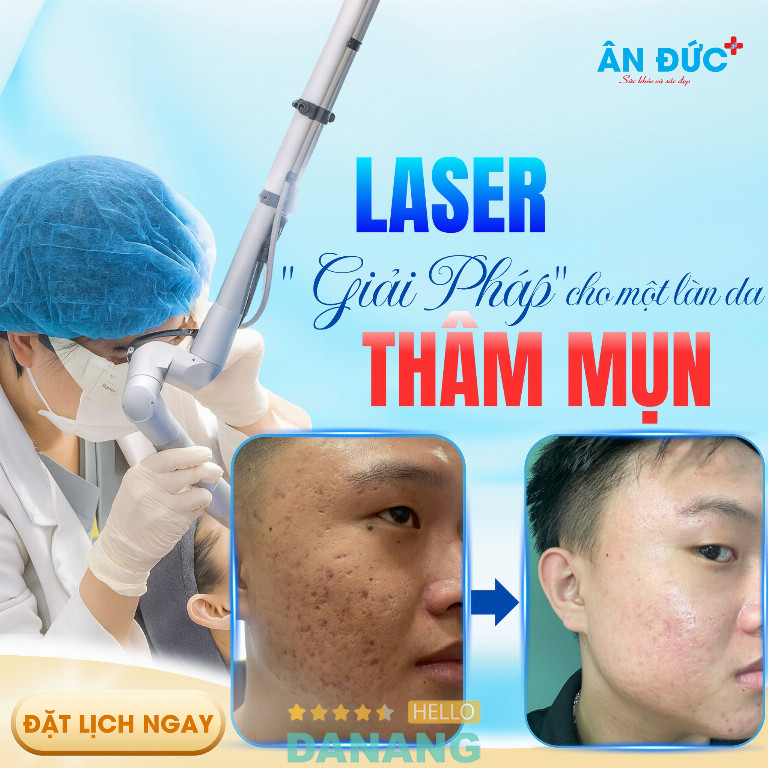 Phòng khám Da Liễu Thẩm Mỹ Ân Đức - P. Liên Chiểu