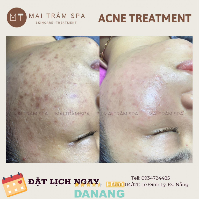 Mai Trâm Spa - P. Thanh Khê