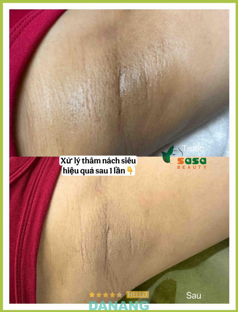 SASA Beauty - P. Hải Châu