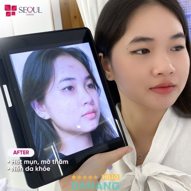 Thẩm Mỹ Seoul Center - P. Thanh Khê