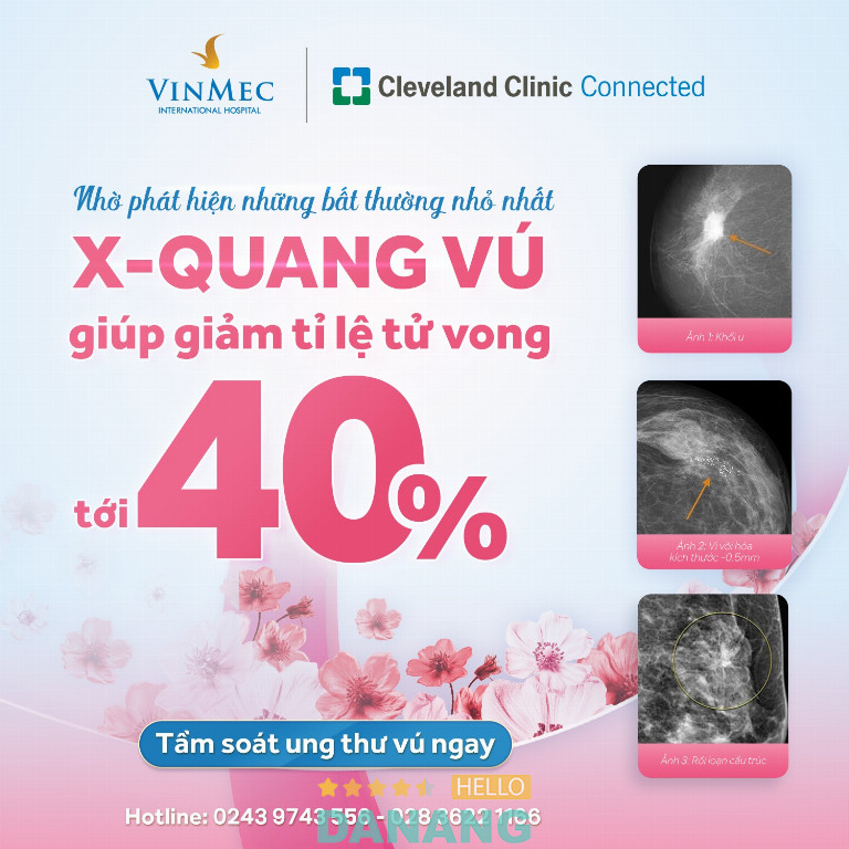 Bệnh viện Đa khoa Quốc tế Vinmec Đà Nẵng – P. Hòa Cường