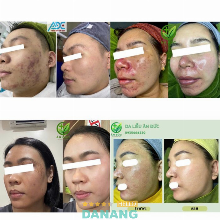 Phòng khám da liễu tại Đà Nẵng